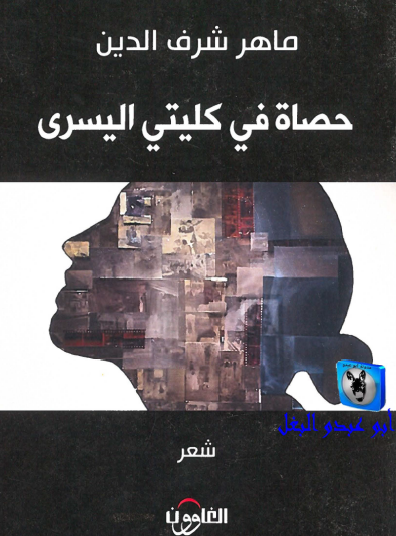 حصاة في كليتي اليسرى